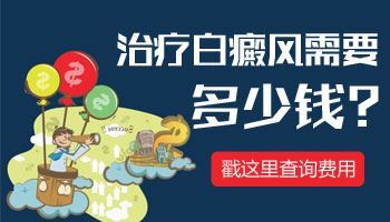 头皮初期白癜风症状